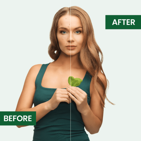 Moiturizing Beauty Cream - Fights Acne, Scars & Dark Spots