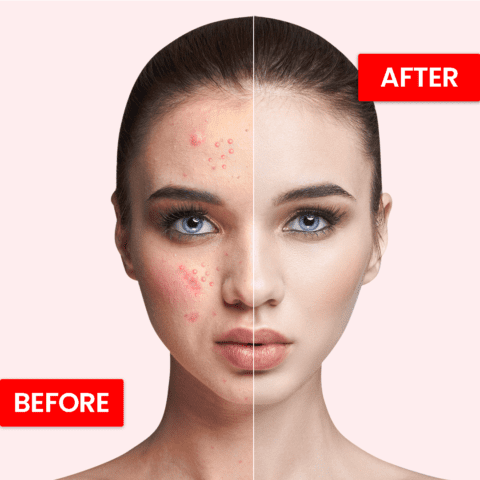 Best Whitening & Moisturizing Skin Beauty Cream | Skin Hydrante