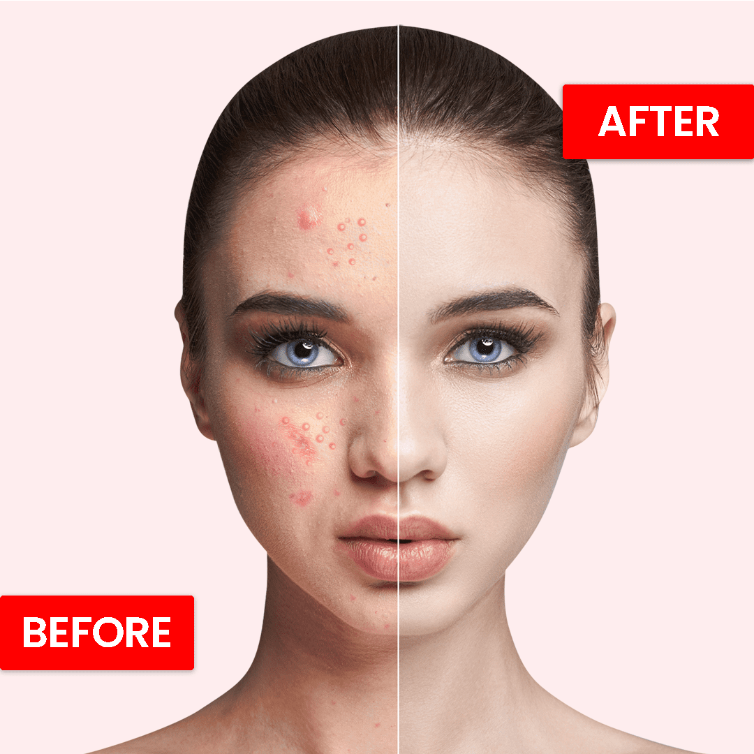 Best Whitening & Moisturizing Skin Beauty Cream | Skin Hydrante