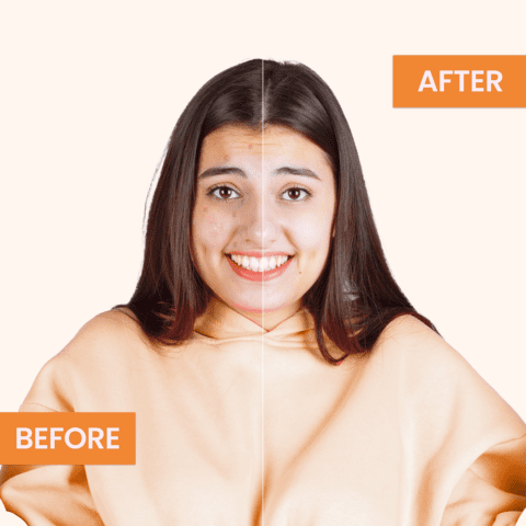 Vitamin C Ampoule 5Ml | Best Skin Care Face & Neck Serums