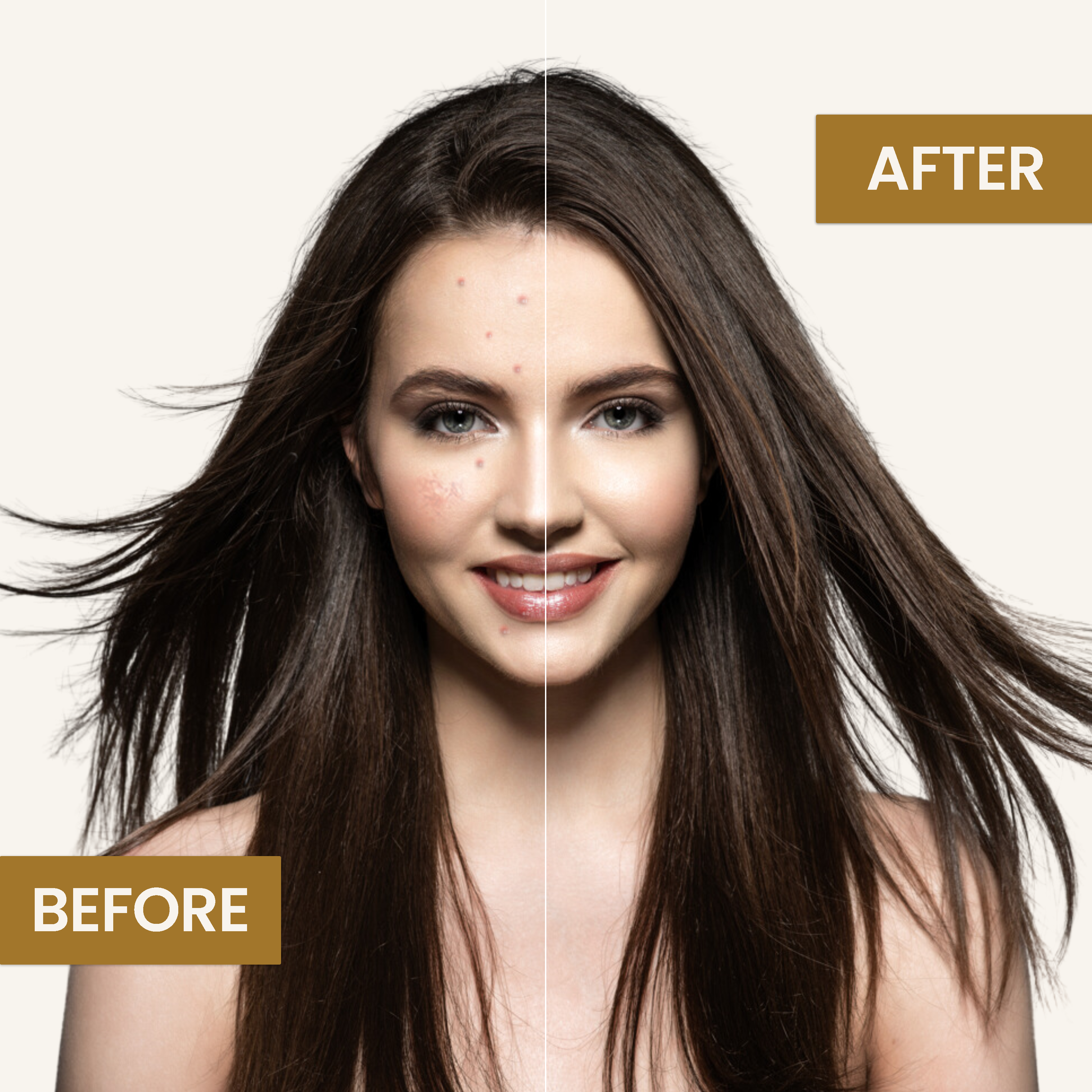 Acne Free Dark Spots Removal Cream - Gold Plus Beauty Cream