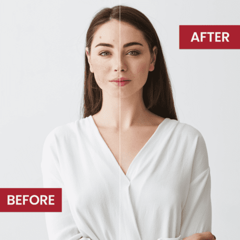 Whitening Soap Dry Skin | Best Hydrating Skin Care Products