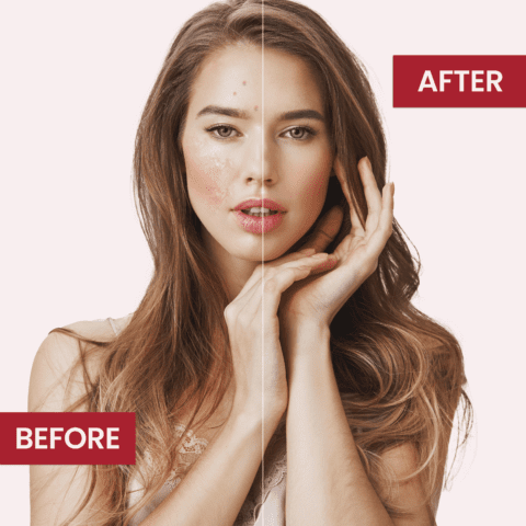 Whitening & Moisturizing Soap Normal Skin | Best Skin Care