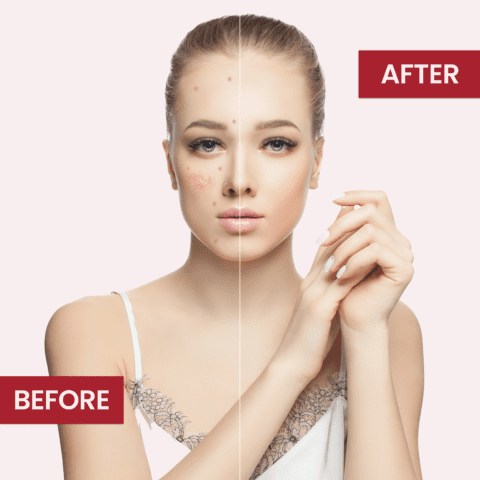 Whitening & Hydrating Soap For Oily Skin | Best Skin Care