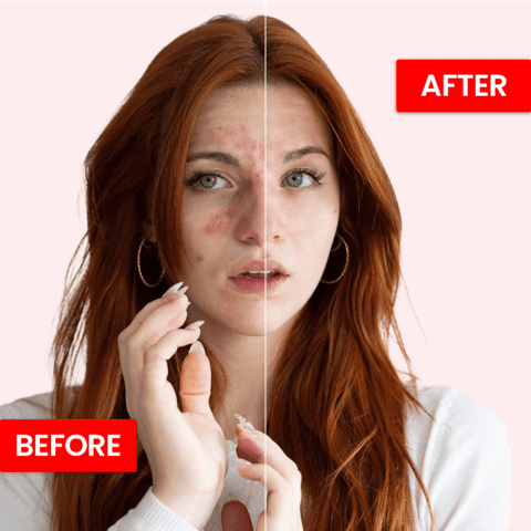 Moisturizing Beauty Serum | Best Skin Care Ampoule